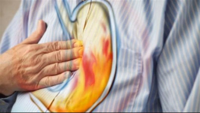 علاج حموضة المعدة،