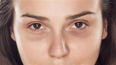 احتفالات ليلة رأس السنة، وصفات طبيعية لعلاج الهالات السوداء