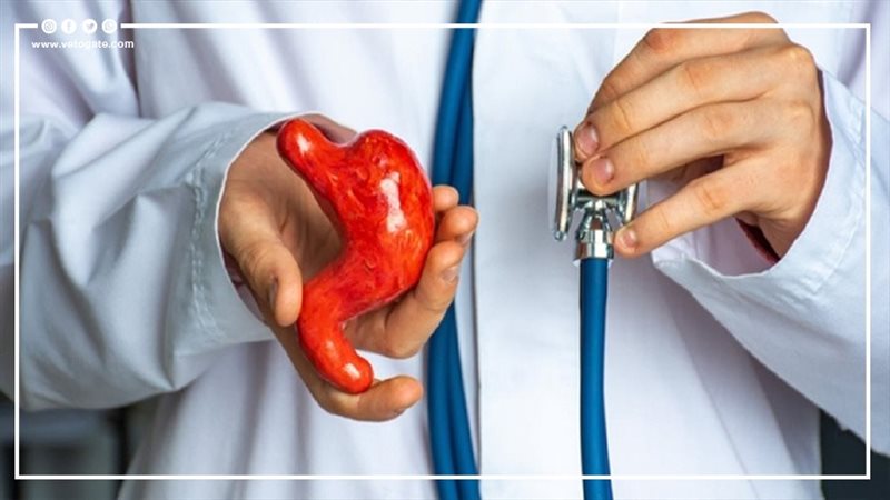 عمليات تكميم المعدة