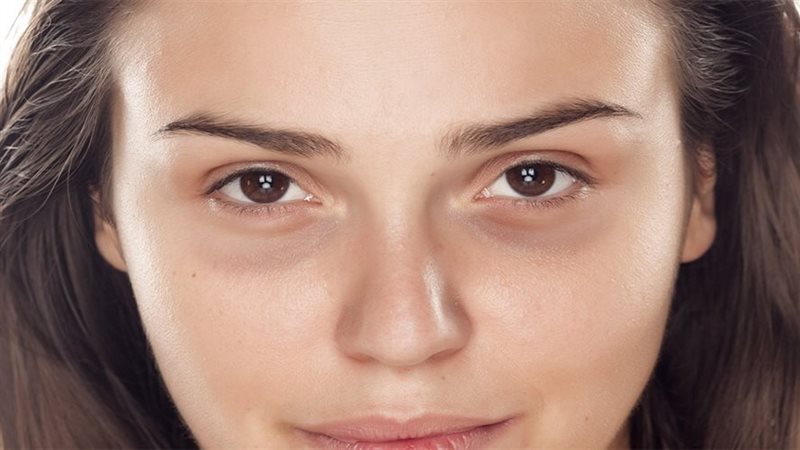 الهالات السوداء،