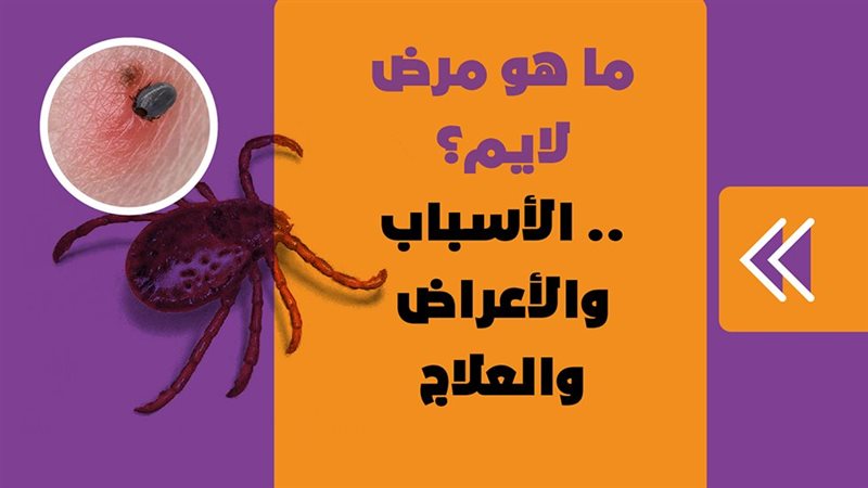مرض لايم 