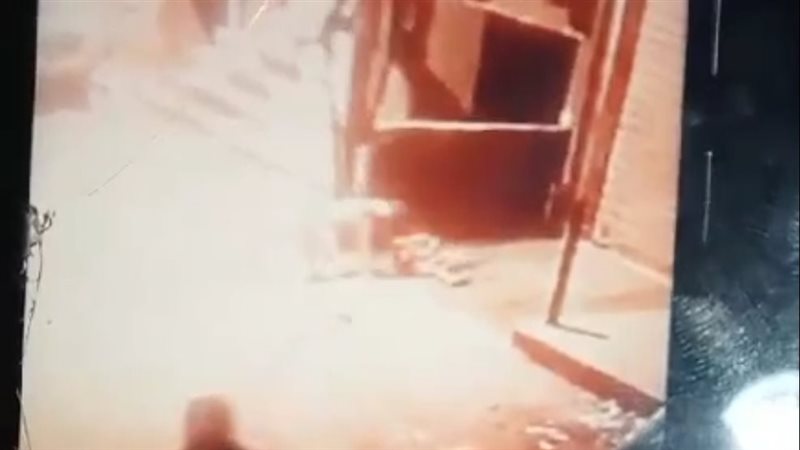 كلب يعقر طفل في الإسماعيلية،