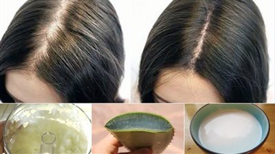  وصفات طبيعية لتقوية الشعر وعلاج تساقطه