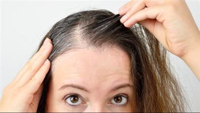 مكونات بسيطة لعلاج تساقط الشعر