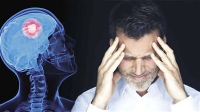 الصداع المفاجئ أبرزها، 6 مؤشرات للإصابة بالسكتة الدماغية و3 إجراءات للإنقاذ المبكر
