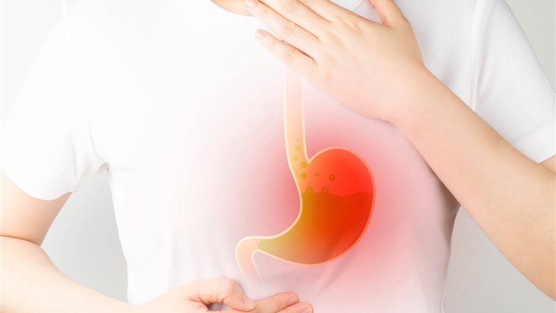 ارتجاع المريء