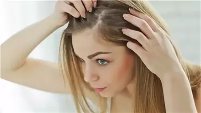وصفة طبيعية تقضي على الفطريات والالتهابات بفروة الرأس 
