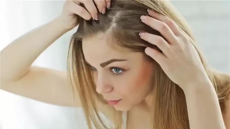 التهابات فروة الرأس