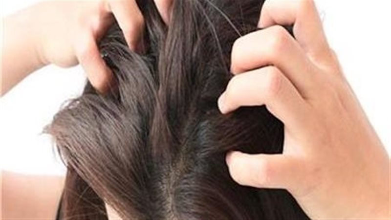 فروة الرأس 