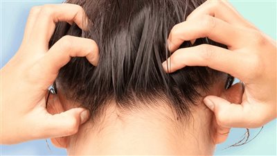 وصفة الألوفيرا لعلاج حكة فروة الرأس