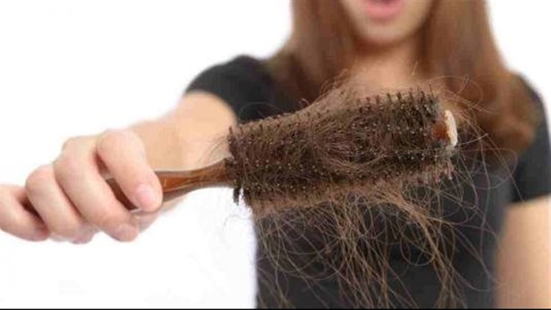 تساقط الشعر 