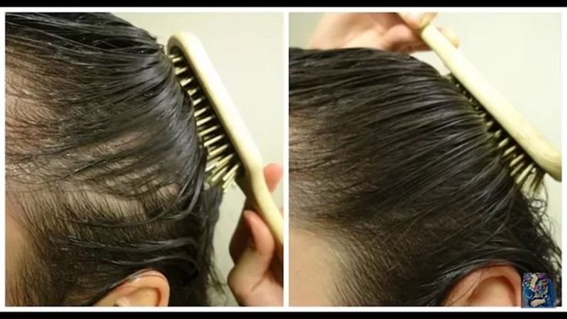 وصفات لتكثيف الشعر،