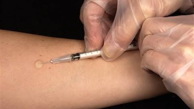 على من تقع المسئولية في أزمة وفاة سيدة بسبب حقنة مضاد حيوي؟
