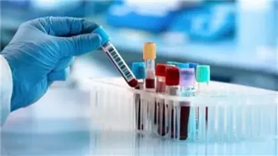 مافيا التحاليل الطبية.. تسريب بيانات المرضى.. أحدث جرائم معامل التحاليل.. قاعدة بيانات للمتبرعين بزراعة الأعضاء.. ونسبة على كل 