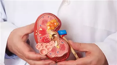  معهد الكلى يحذر المرضى من تجاهل شرب الماء لهذا السبب
