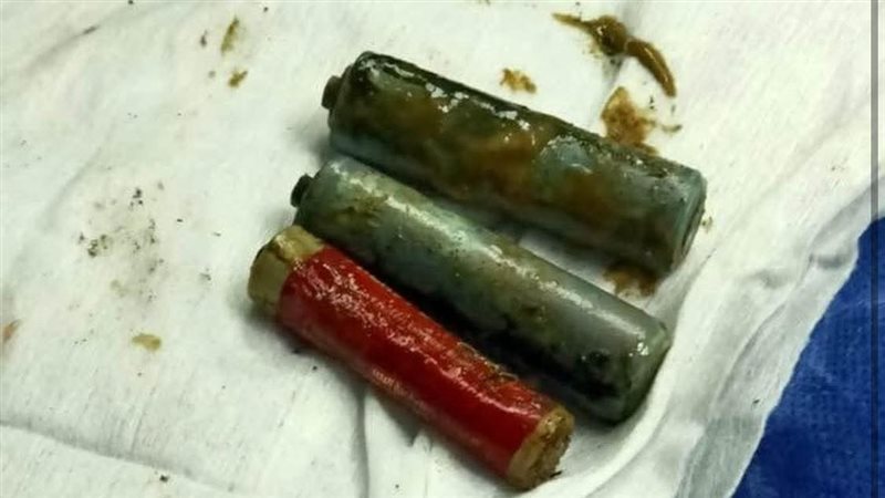 استخراج 3 أحجار ريموت