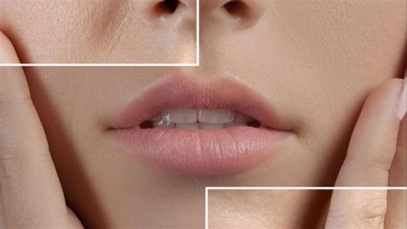 علاج المسامات الواسعة
