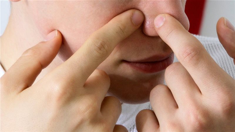 وصفات لإزالة الرؤوس
