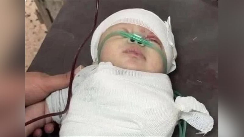 الطفلة الشهيدة شام