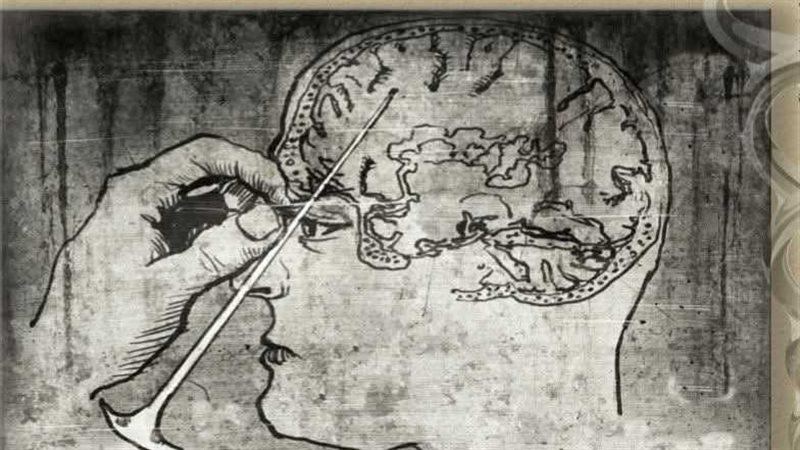 الطب والمجتمع،فيتو