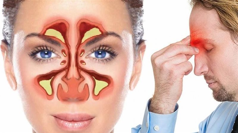 صداع الرأس وعلاجه
