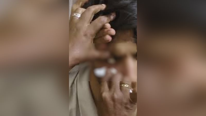 لحظة إخراج حجر من