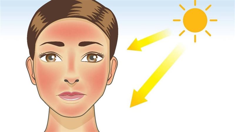 ماسكات لعلاج حروق