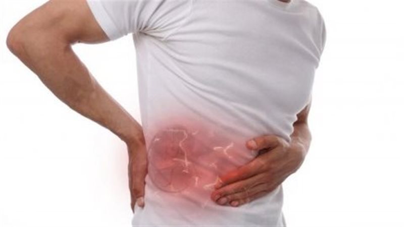 أعراض حصوات الكلى