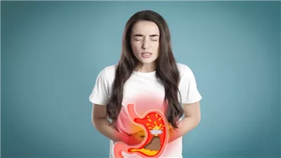 أعراض ارتجاع المريء وأسبابه ومخاطره، يجب الحذر منه
