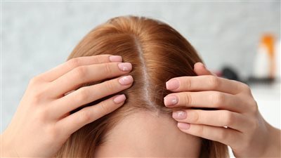 وصفة طبيعية لعلاج الشعر الخفيف وزيادة جماله