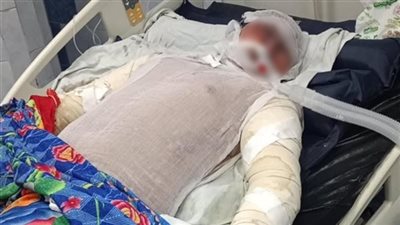 رفض مغادرة المحل، وفاة بطل حريق شبرا الخيمة متأثرًا بإصاباته