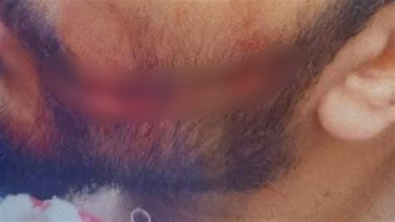 الطبيب المعتدي عليه