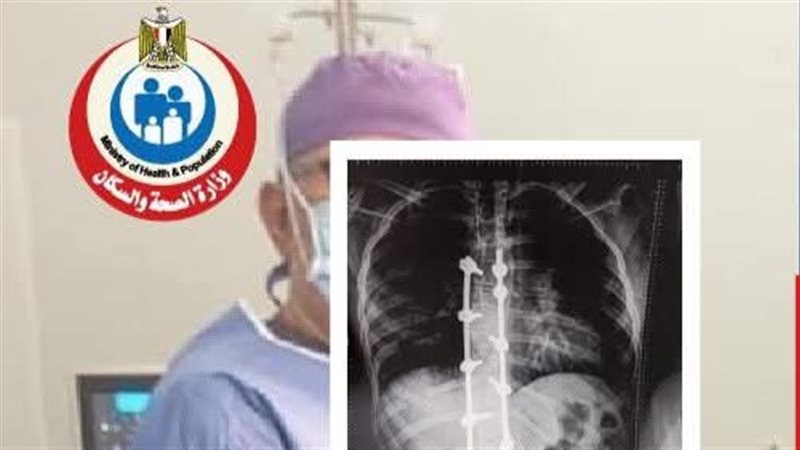نجاح إصلاح اعوجاج