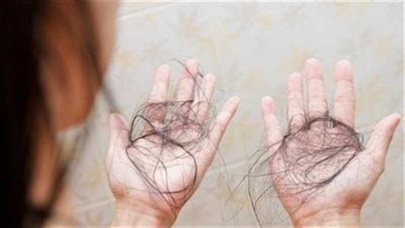 علاج تساقط الشعر،