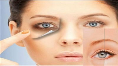 طرق طبيعية للتخلص من الهالات السوداء تحت العين