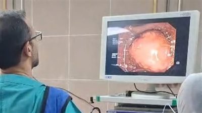 استئصال ورم بدون جراحة بالقنوات المرارية بوحدة المناظير بمستشفى أحمد ماهر التعليمي