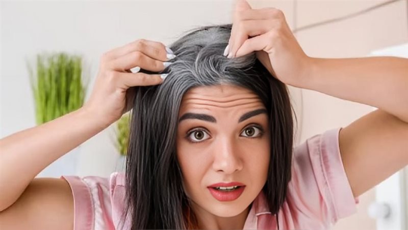 الشيب المبكر 