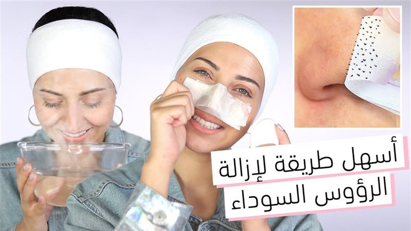 علاج الرؤوس السوداء