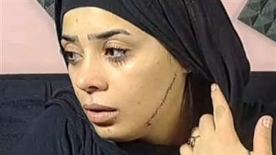 غدا، أولى جلسات محاكمة المتهمة بتشويه عروس مصر القديمة بـ 41 غرزة