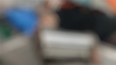 مستشفى العجمي ينقذ شابا علقت يده في مفرمة لحوم 