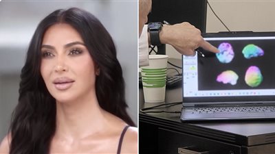 معاناة كيم كارداشيان من 