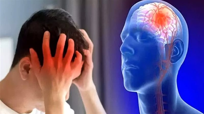 السكتات الدماغية،