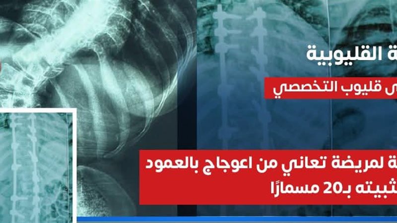 مستشفي قليوب التخصصي