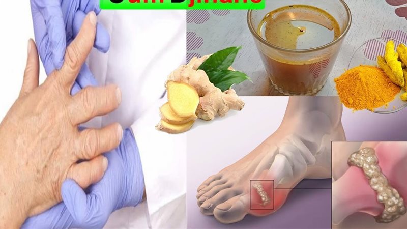 علاج آلام المفاصل