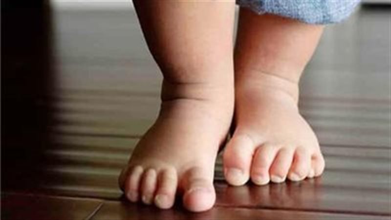 برودة الأطراف 