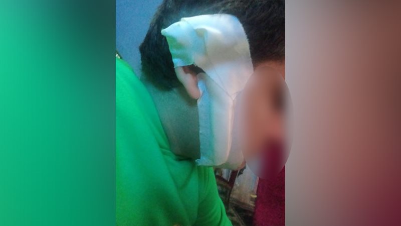 الطفل المصاب
