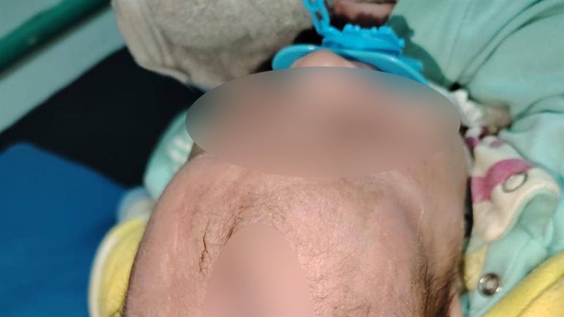  إنقاذ حياة الرضيع