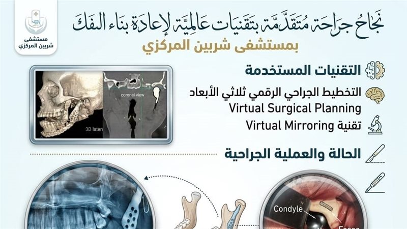 جراحة وجه بصحة الدقهلية،