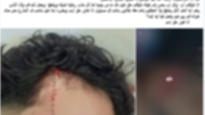 ضبط مرتكب التعدي