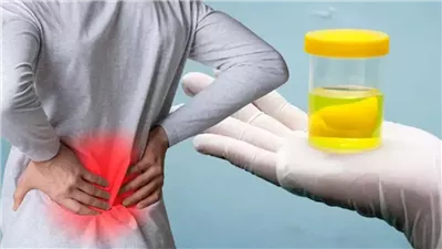 إهماله يسبب مضاعفات خطيرة، علاج زلال البول وأسباب الإصابة به